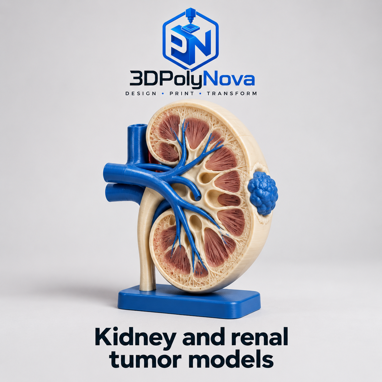 Healthcare & Educational Models: Printed Kidney and Renal Tumor Model-2